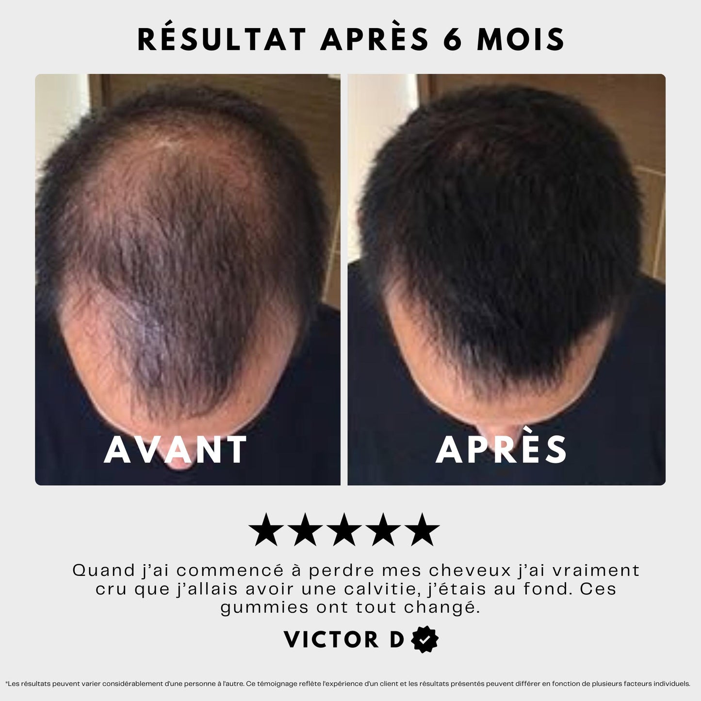 Gummies pour Cheveux